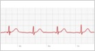 Hands-on with the ECG feature in Apple Watch Series 4: taking an ECG is easy, but the ECG trace can only be viewed on the iPhone, not the watch itself (John Timmer/Ars Technica)