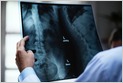 Dutch startup Aidence, which works on early recognition of lung cancer using AI in medical imaging, raises &euro;10M Series A led by INKEF Capital and Rabo Ventures (Andrii Degeler/Tech.eu)