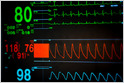 Researchers say a networking protocol flaw in two popular hospital anesthesia and respiratory devices made by GE could enable malicious remote tampering (Zack Whittaker/TechCrunch)
