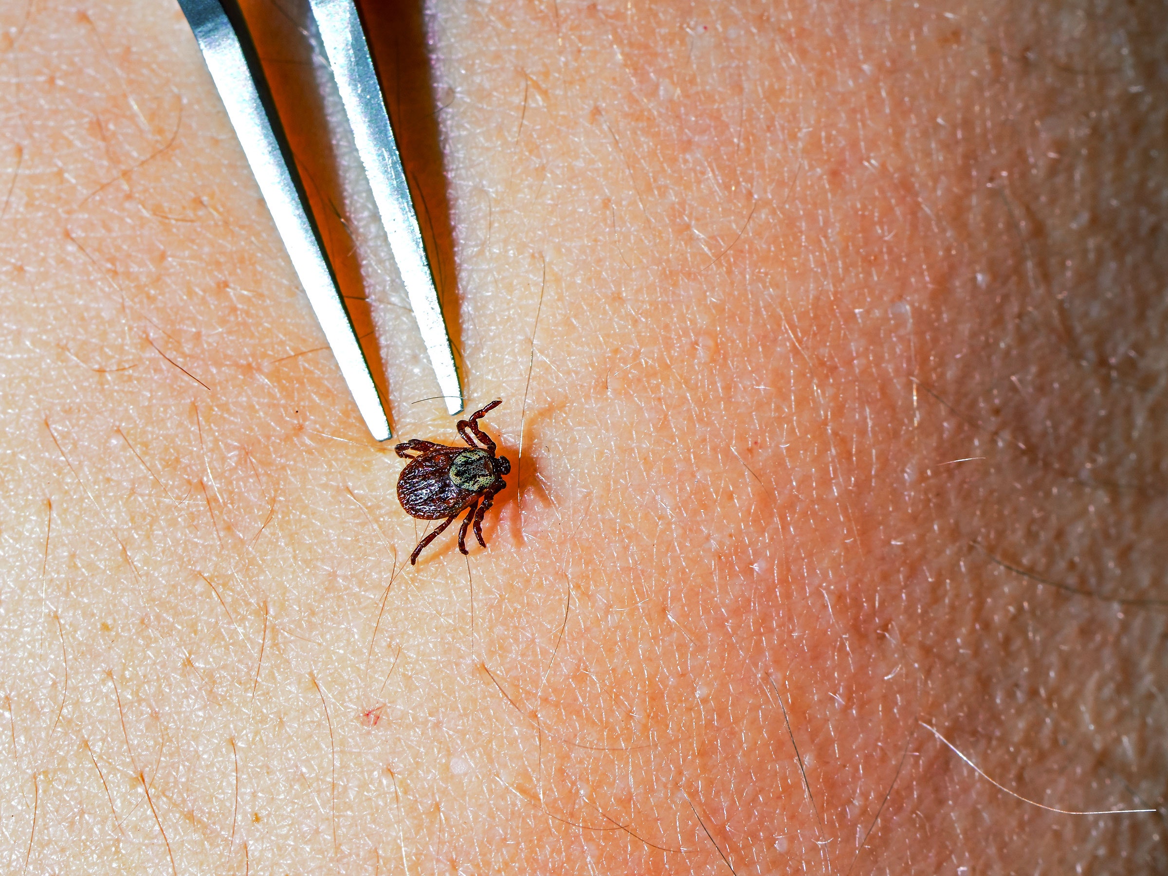A Pill That Kills Ticks Is a Promising New Weapon Against Lyme Disease