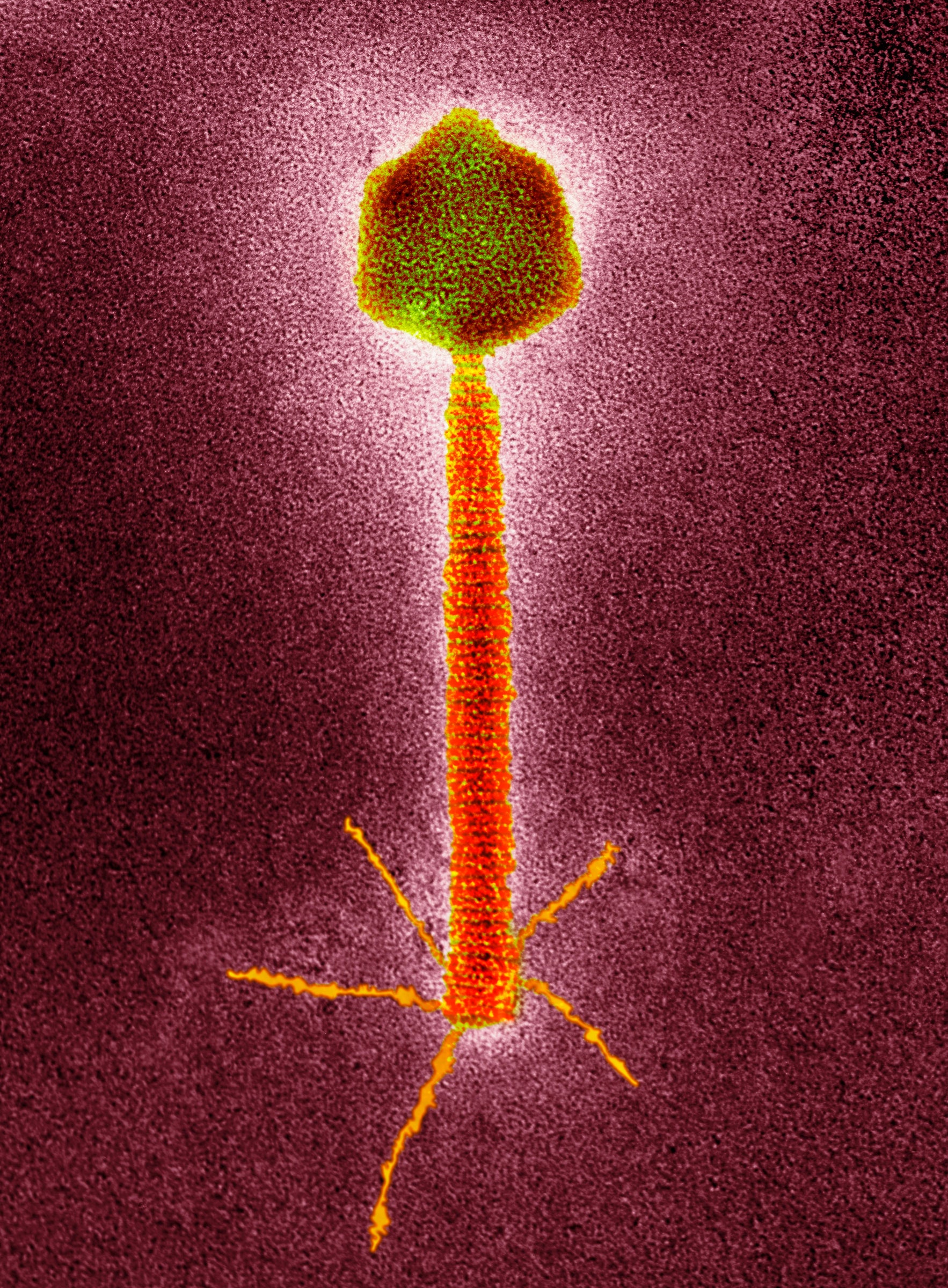 A Virus Found in Wastewater Beat Back a Woman’s ‘Zombie’ Bacteria